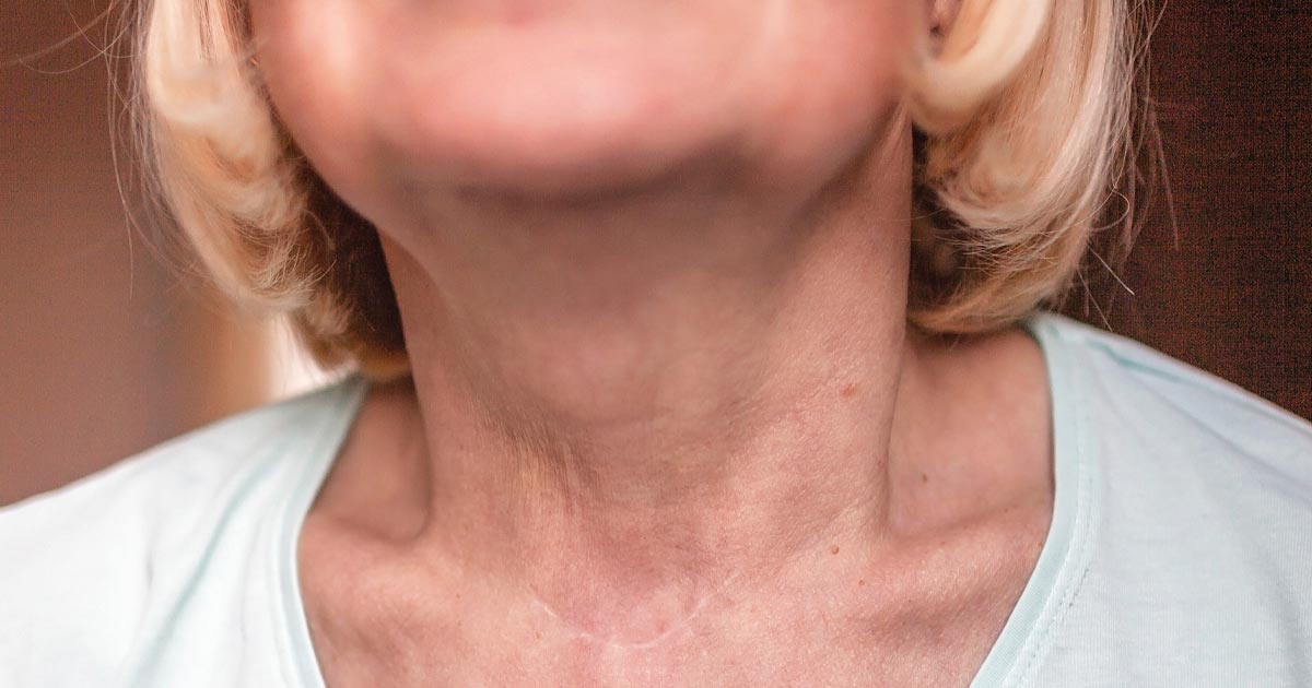 closeup photo of a senior woman's neck