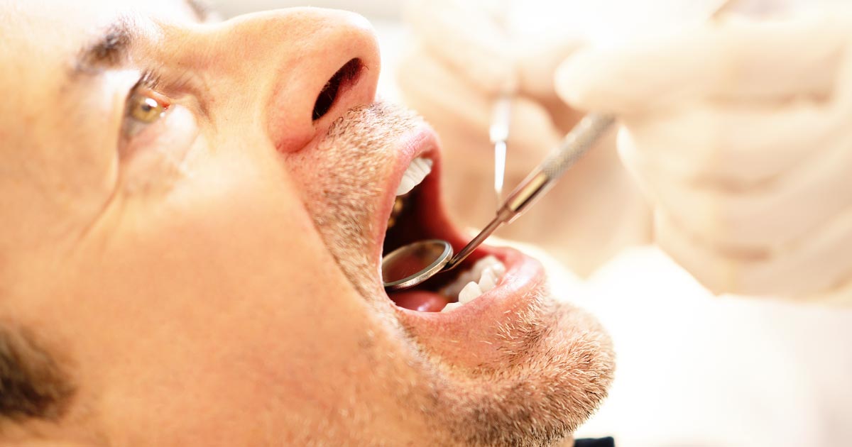 Closeup photo of an elderly man with his mouth open, getting dental work.