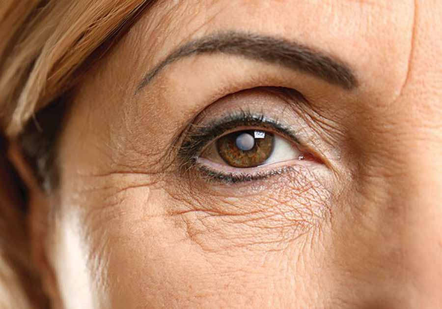 Close up of aging eye.